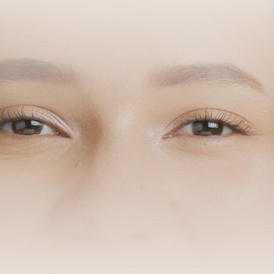trockene Augen
